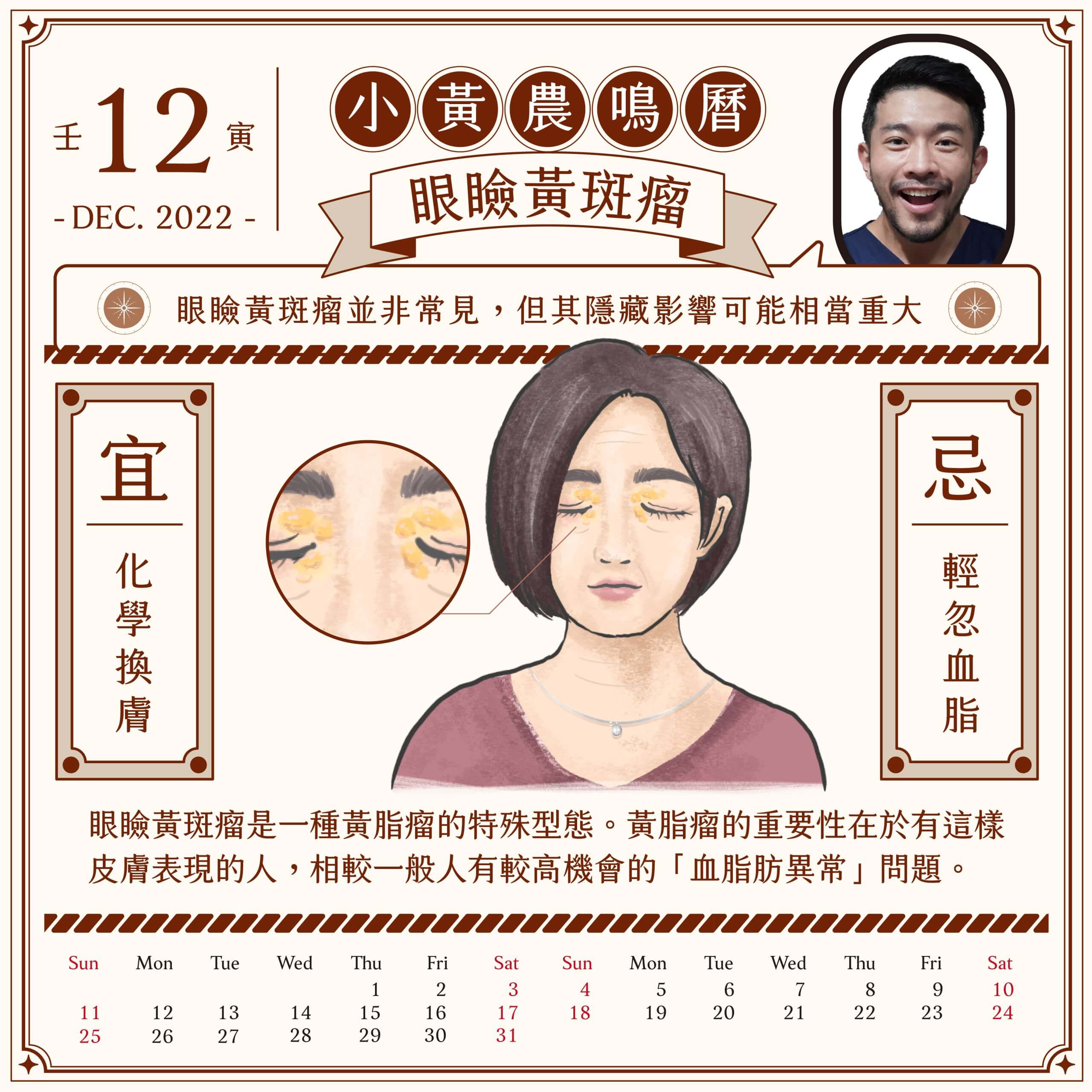 Read more about the article 眼瞼黃斑瘤