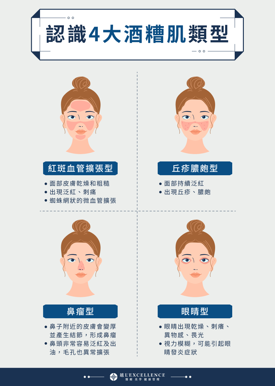 認識4大酒糟肌類型