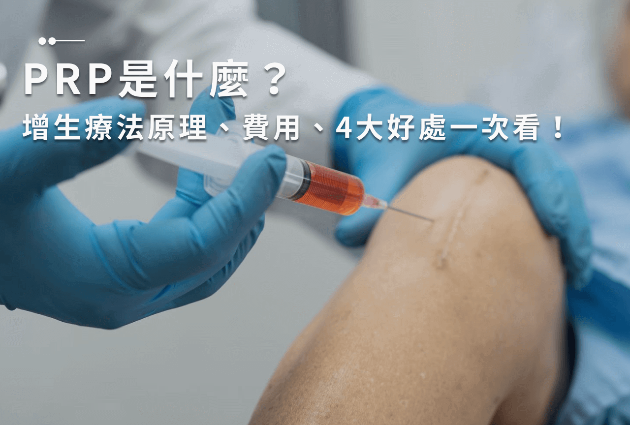 PRP是什麼？增生療法原理、費用、4大好處一次看！