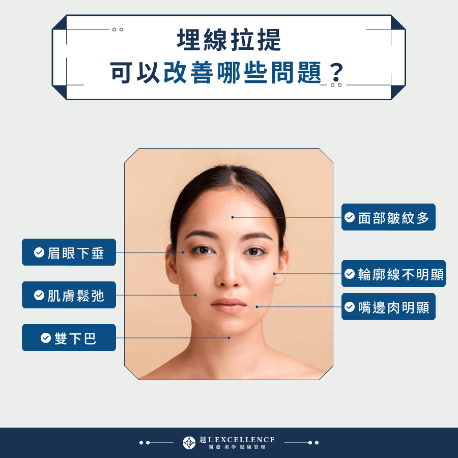 埋線拉提可以改善哪些問題？