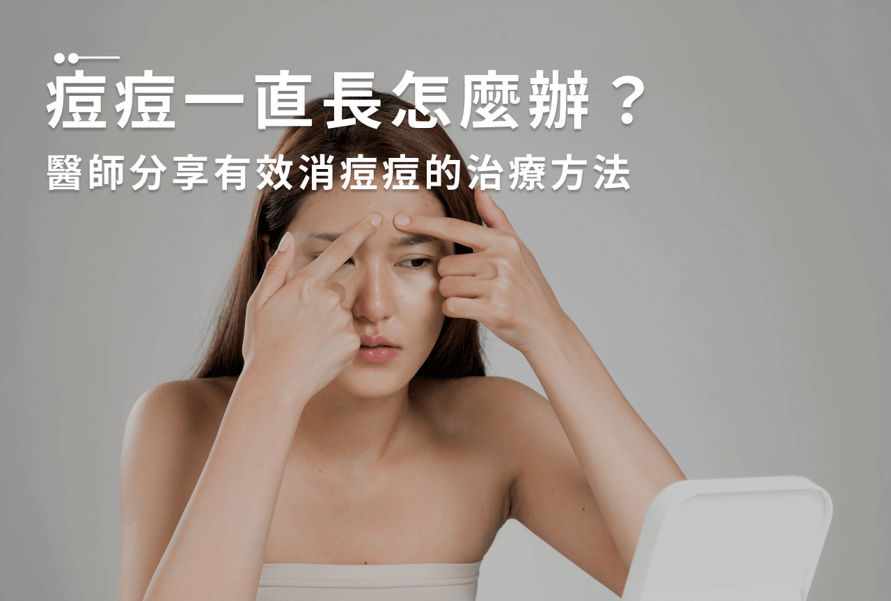 Read more about the article 痘痘一直長怎麼辦？醫師分享有效消痘痘的治療方法！