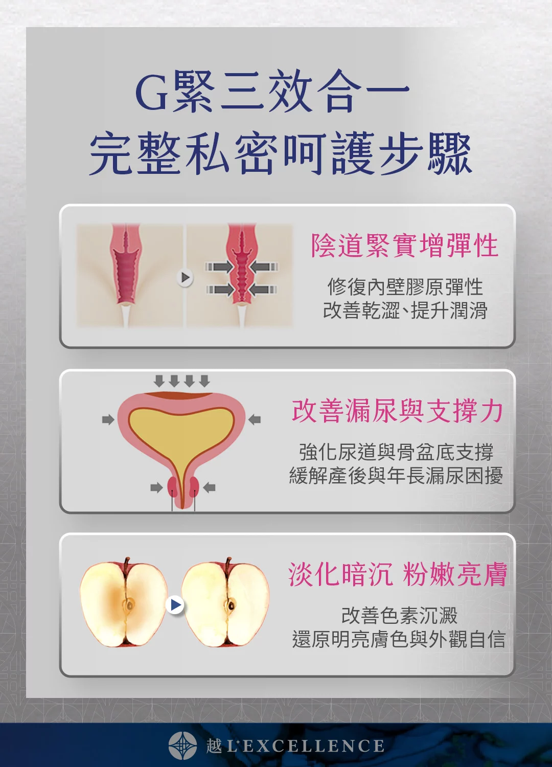 G緊雷射 漏尿 性愛不適 私密處感染 暗沉 越診所 Mb03