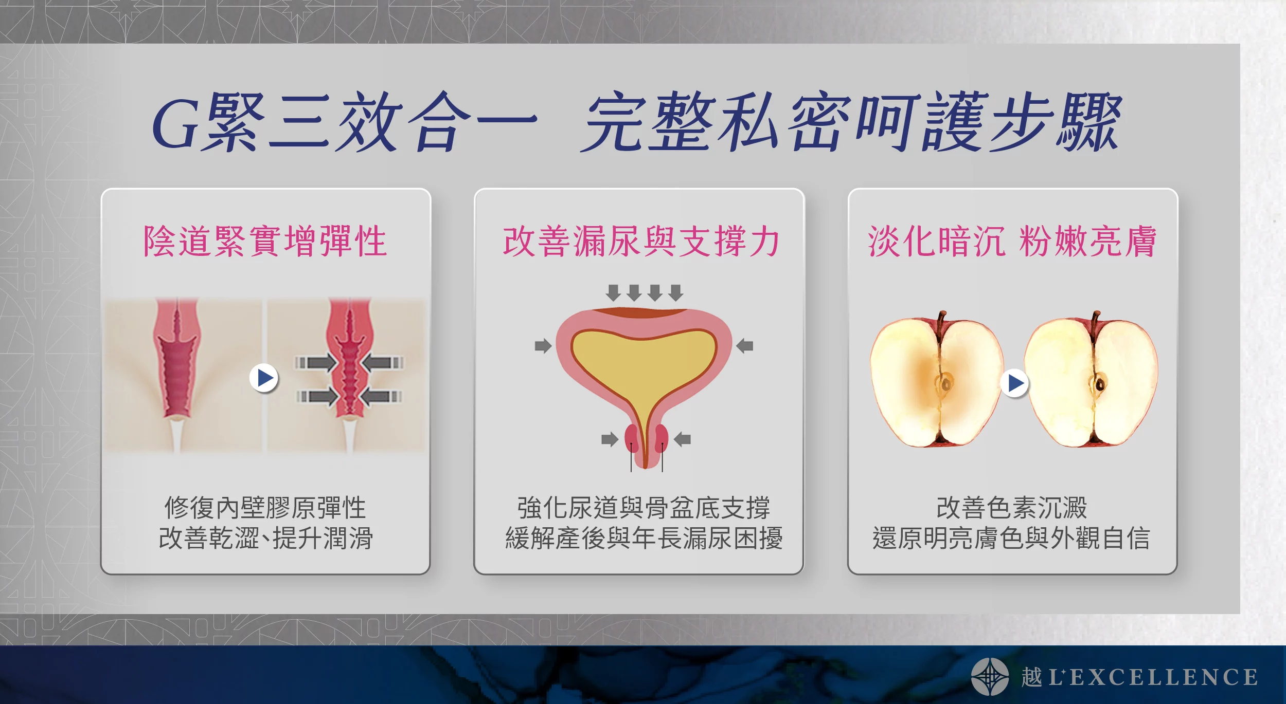G緊雷射 漏尿 性愛不適 私密處感染 暗沉 越診所03