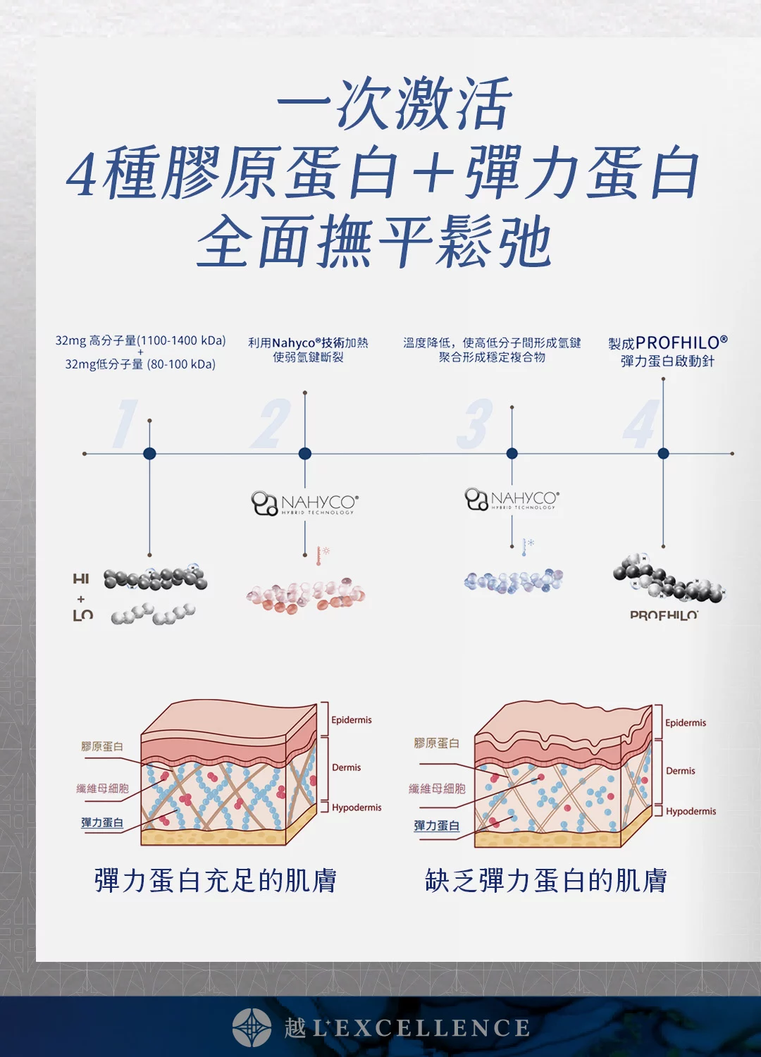 逆時針 Profhilo 璞菲洛 液態電波 玻尿酸 彈力蛋白 脖紋 頸紋 越診所 Mb02