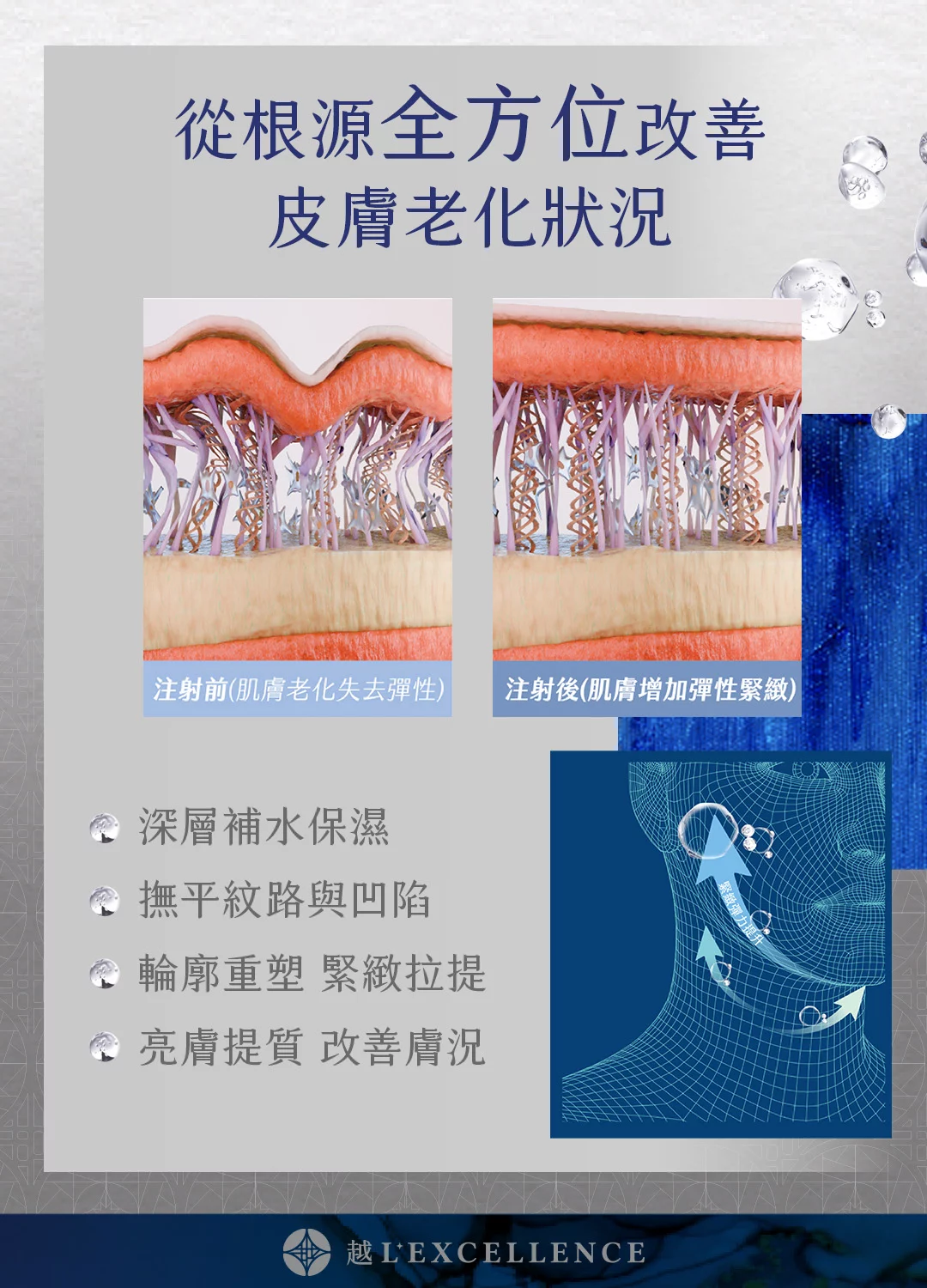 逆時針 Profhilo 璞菲洛 液態電波 玻尿酸 彈力蛋白 脖紋 頸紋 越診所 Mb03